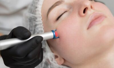 Laser Treatments