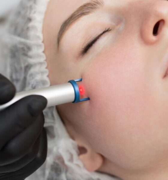 Laser Treatments
