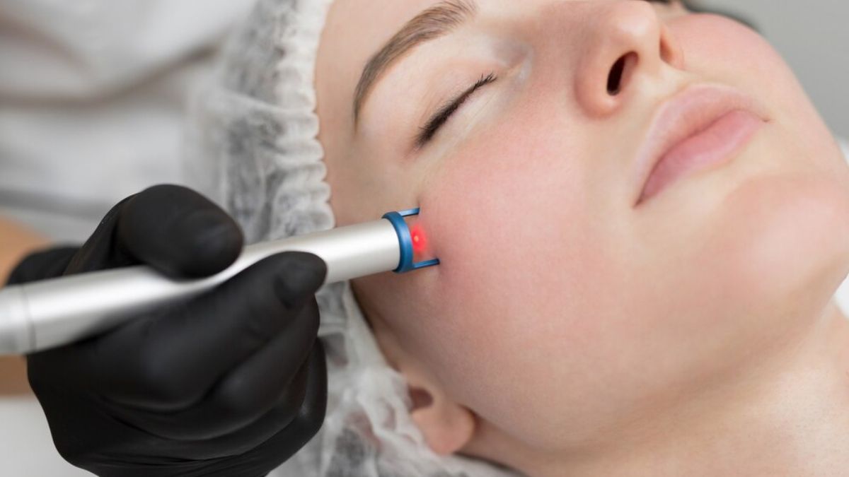 Laser Treatments