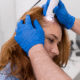 Hair Restoration